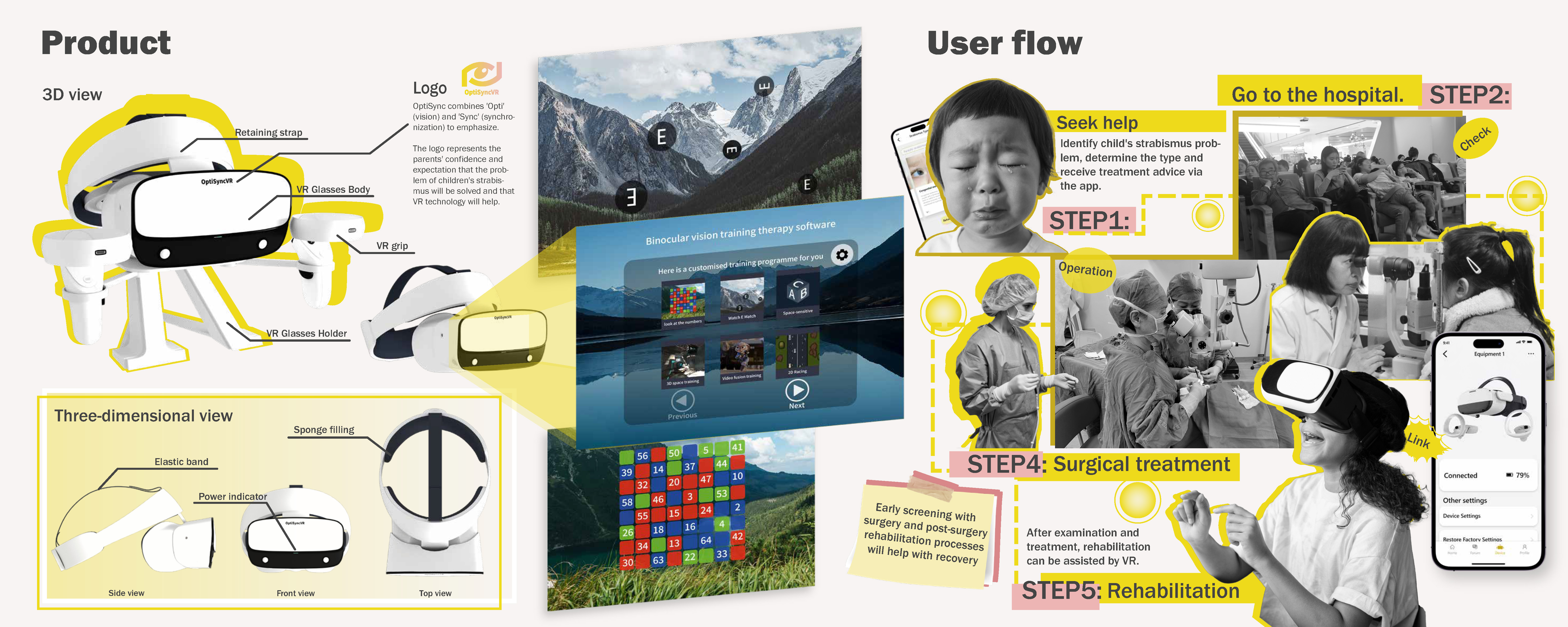 Strabismus — VR product 1